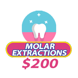 price for molar extractions in somos dental phoenix